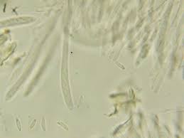 Attēlu rezultāti vaicājumam “Mollisia uda”