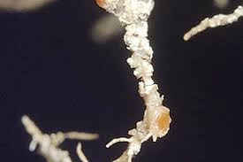 Attēlu rezultāti vaicājumam “Biatoropsis usnearum”