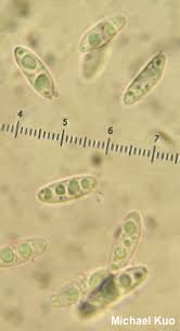Attēlu rezultāti vaicājumam “Bisporella citrina”