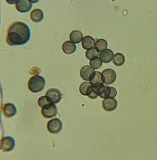 Attēlu rezultāti vaicājumam “Physarum virescens”