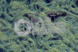 Attēlu rezultāti vaicājumam “Nostoc commune cells”