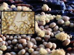 Attēlu rezultāti vaicājumam “Trichia contorta spores”