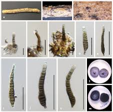 Attēlu rezultāti vaicājumam “Rosellinia desmazieri spores”