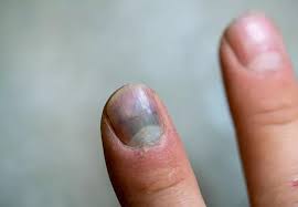 Image result for lunula nail