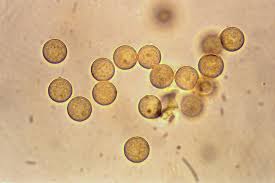 Attēlu rezultāti vaicājumam “Licea minima spores”
