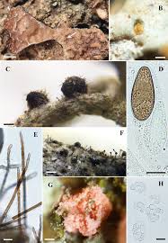 Attēlu rezultāti vaicājumam “Lichenoconium xanthoriae”