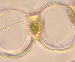 Attēlu rezultāti vaicājumam “Sphagnum centrale sporophyte”