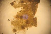 Attēlu rezultāti vaicājumam “Tranzschelia anemones”