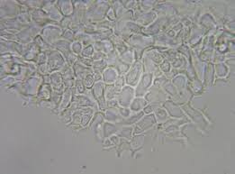 Attēlu rezultāti vaicājumam “Athelia pyriformis”