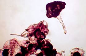 Attēlu rezultāti vaicājumam “Acalitus longisetosus”