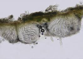 Attēlu rezultāti vaicājumam “Pertusaria leioplaca”