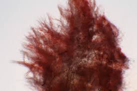 Attēlu rezultāti vaicājumam “Sidera lenis”