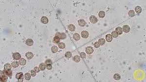 Attēlu rezultāti vaicājumam “Symphytocarpus trechisporus spores”