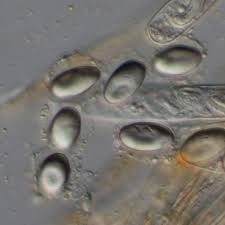 Attēlu rezultāti vaicājumam “Cheilymenia stercorea”