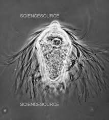 Attēlu rezultāti vaicājumam “Trichia longipalpis spores”