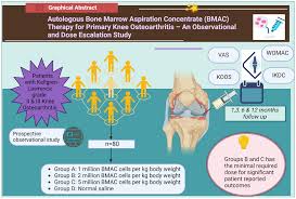 Image result for BMAC