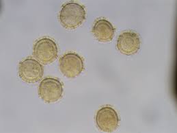 Attēlu rezultāti vaicājumam “Oligonema persimile macro”