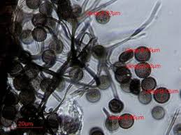 Attēlu rezultāti vaicājumam “Symphytocarpus flaccidus spores”