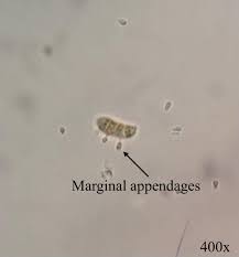 Attēlu rezultāti vaicājumam “Dacrymyces chrysospermus spores”