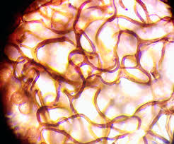 Attēlu rezultāti vaicājumam “Comatricha elegans stalked”