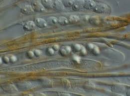 Attēlu rezultāti vaicājumam “Octospora humosa”