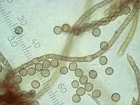 Attēlu rezultāti vaicājumam “Trichia scabra spores”
