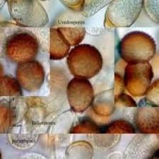 Attēlu rezultāti vaicājumam “Tranzschelia pruni-spinosae spores”