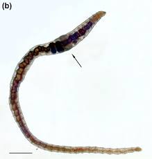 Attēlu rezultāti vaicājumam “Hirudinea”