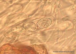 Attēlu rezultāti vaicājumam “Humaria hemisphaerica”