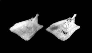 Image result for Minytrema melanops