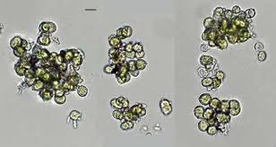 Attēlu rezultāti vaicājumam “Pleurococcus vulgaris”