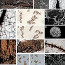 Attēlu rezultāti vaicājumam “Amaurochaete atra spores”