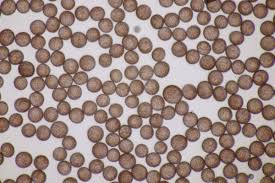 Attēlu rezultāti vaicājumam “Didymium tussilaginis spores”