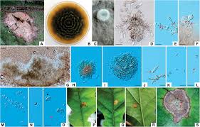 Attēlu rezultāti vaicājumam “Badhamia dubia spores”