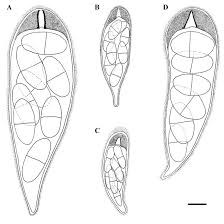 Attēlu rezultāti vaicājumam “Megalaria grossa”