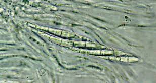 Attēlu rezultāti vaicājumam “Scoliciosporum chlorococcum”