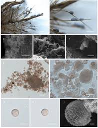 Attēlu rezultāti vaicājumam “Physarum bryomacrocarpum spores”