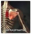 Infraspinatus muscle