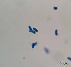 Attēlu rezultāti vaicājumam “Dacrymyces chrysospermus spores”