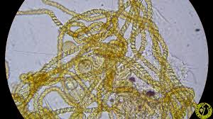 Attēlu rezultāti vaicājumam “Hemitrichia lutescens”