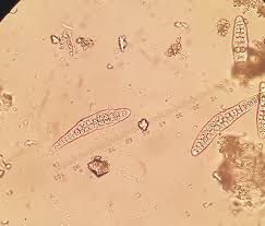 Attēlu rezultāti vaicājumam “Thelotrema lepadinum”