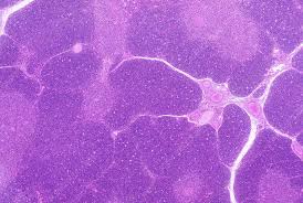 Image result for Thymus