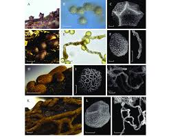 Attēlu rezultāti vaicājumam “Perichaena depressa spores”