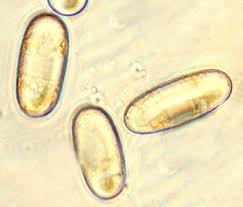 Attēlu rezultāti vaicājumam “Badhamia melanospora spores”