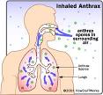 HowStuffWorks "How Anthrax Works"