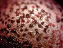 Attēlu rezultāti vaicājumam “Lycogala persicum”