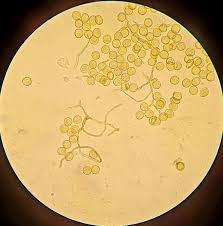 Attēlu rezultāti vaicājumam “Perichaena corticalis”