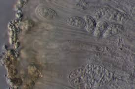 Attēlu rezultāti vaicājumam “Lecanora carpinea”