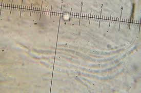 Attēlu rezultāti vaicājumam “Bacidia subincompta”