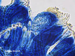 Attēlu rezultāti vaicājumam “Biatora sphaeroides”